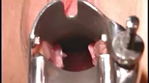 ஜில் காசிடிக்கு மெல்ல பசி